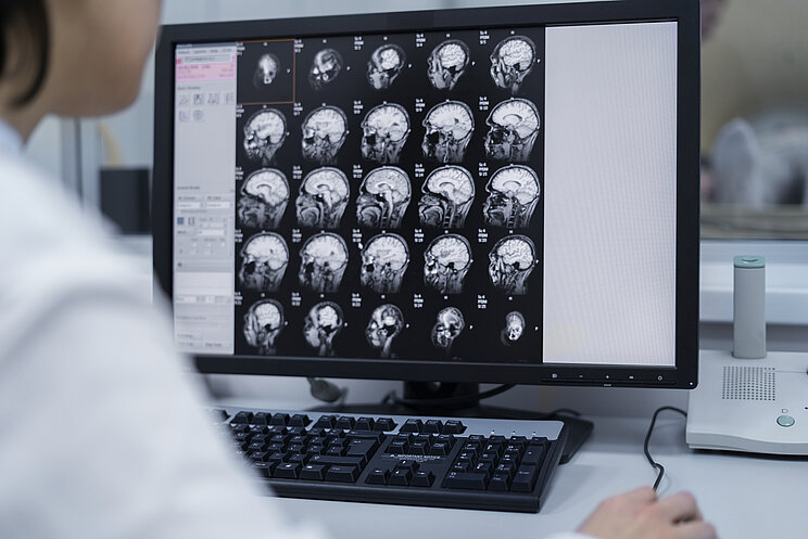 Abbildung eines Computerbildschirm mit EEG Scans eines Gehirns