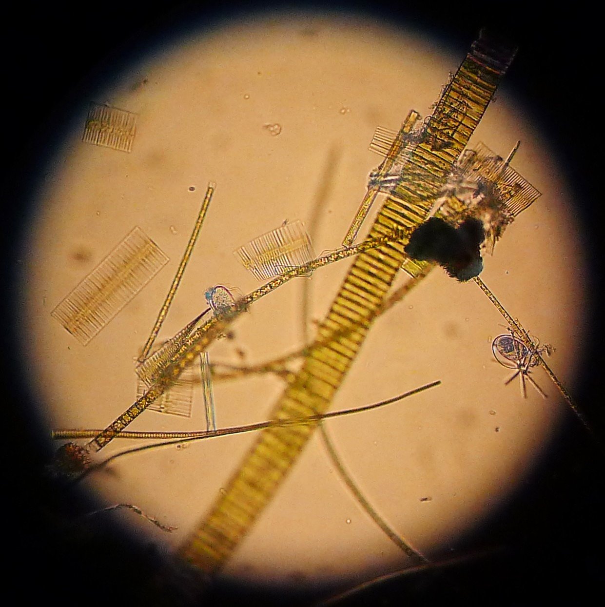 Kieselagen unter dem Mikroskop